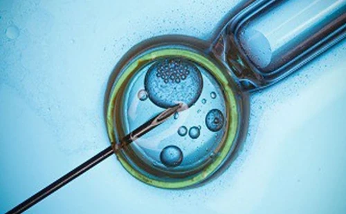 টেস্টটিউব বেবি নেওয়া কি জায়েজ? জানুন ইসলামি বিধান